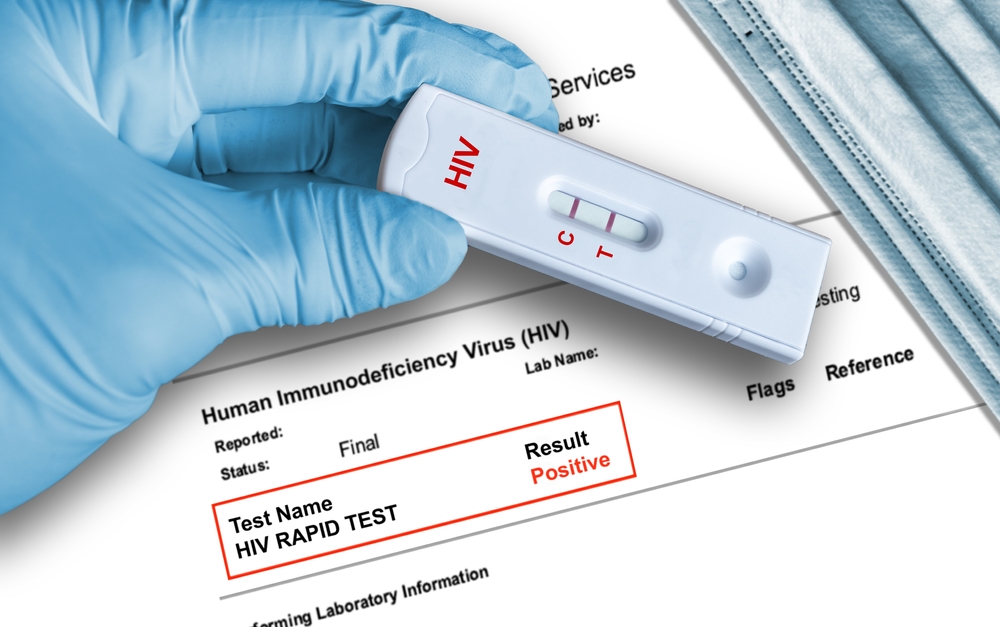 How Soon After Exposure Can HIV Be Detected With PCR Testing?